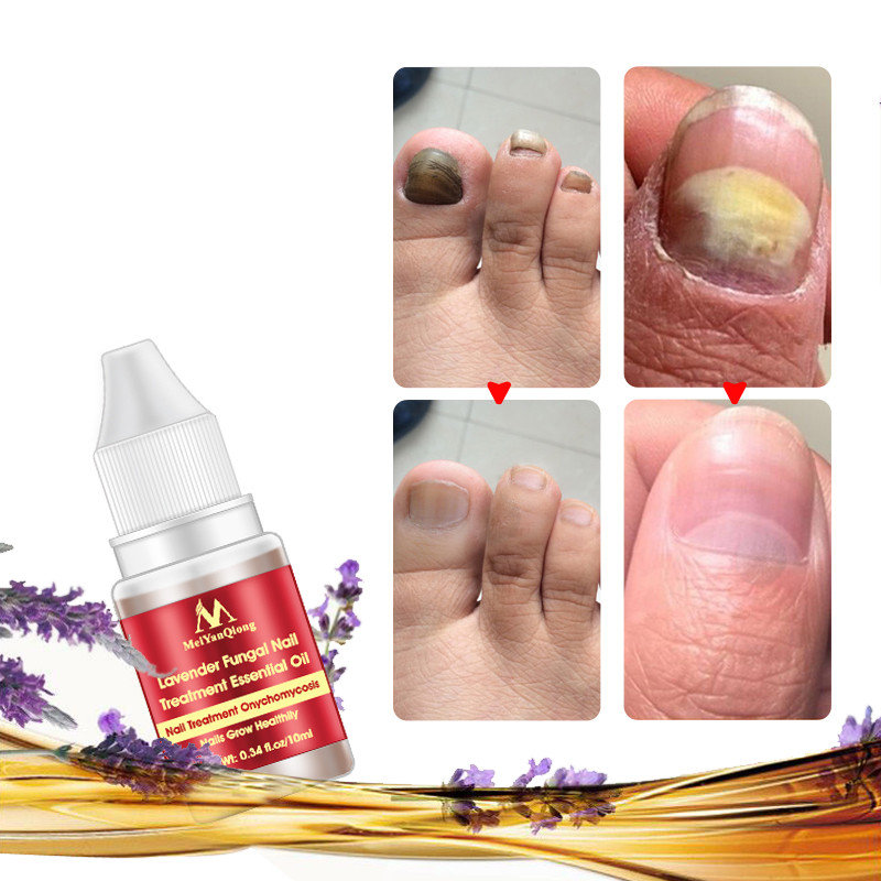 

Lavender Nail Liquid Treatment
