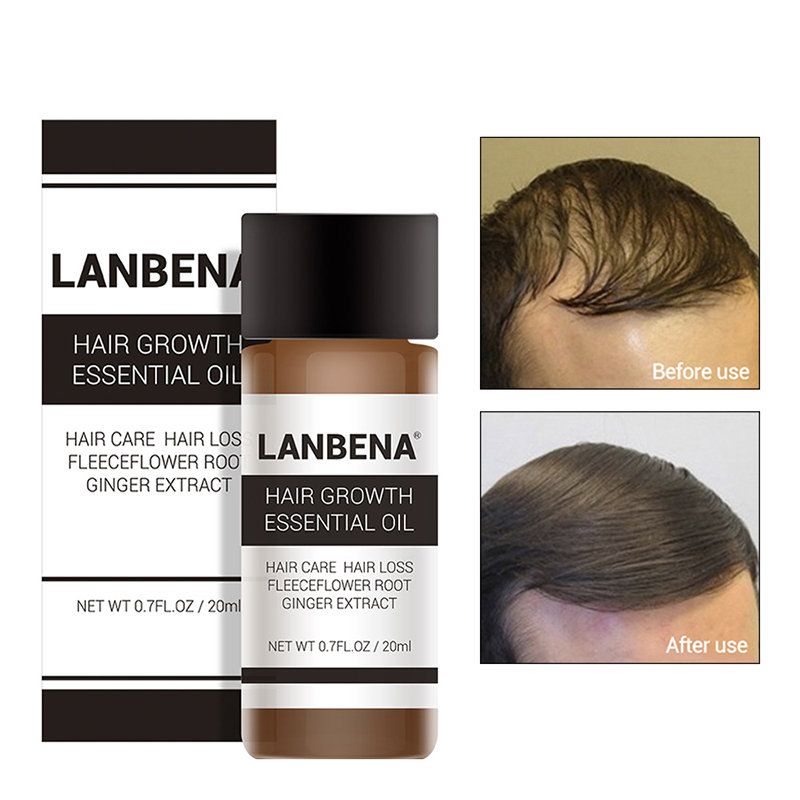 

Hair Growth Essential Oils, White