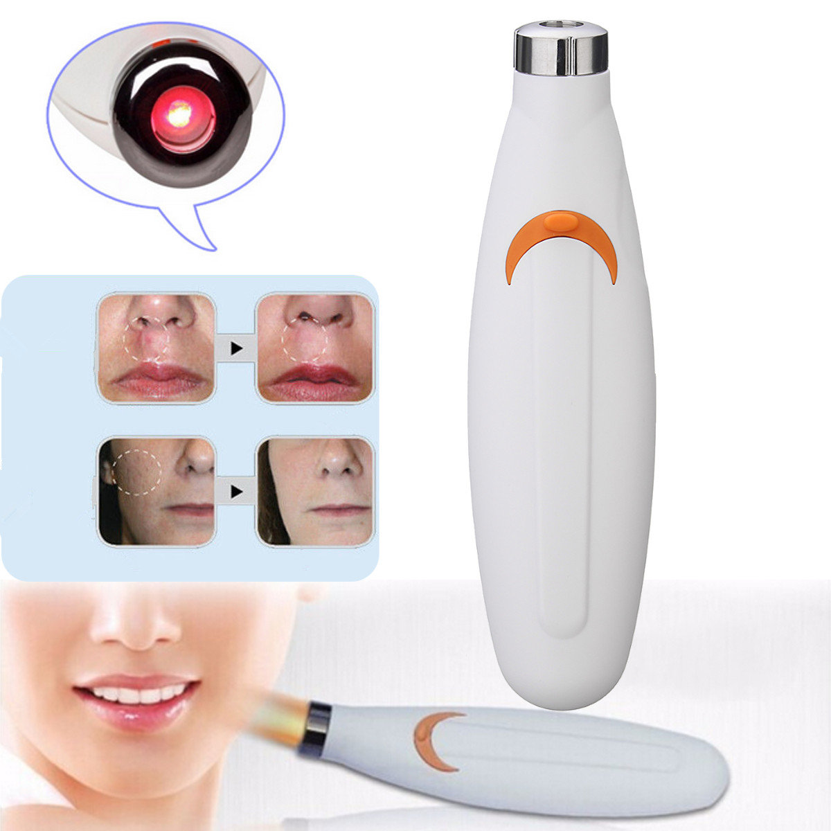 

Laser Therapy Acne Pen Soft Scar Blemish Wrinkle Removal Light Treatment Machine